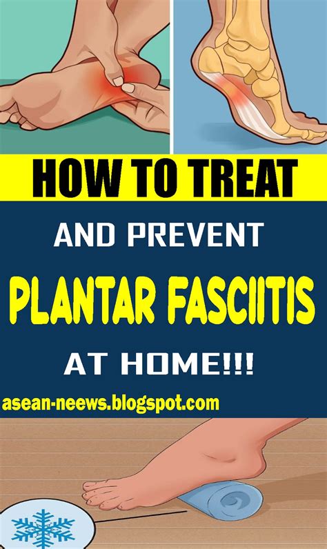 plantar fasciitis webmd|how to cure plantar fasciitis completely.